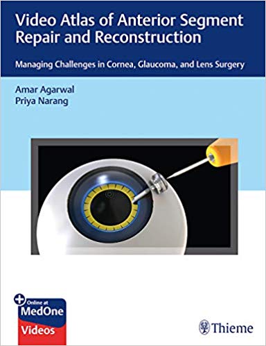 Video Atlas of Anterior Segment Repair and Reconstruction Managing Challenges in Cornea, Glaucoma, and Lens Surgery